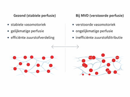 vergelijking van gezonde en beperkte microcirculatie