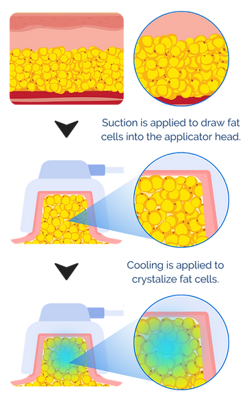 Image_4.png