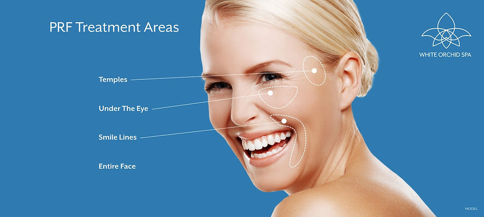 PRF microneedling procedure in progress for skin rejuvenation.