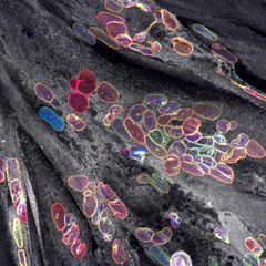 iMM Joins the MAGIC Consortium to Advance Research on Muscular Dystrophies