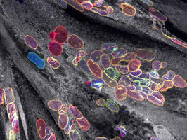 iMM Joins the MAGIC Consortium to Advance Research on Muscular Dystrophies