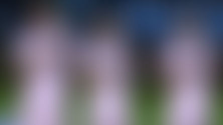 Millonarios: cuando la fragilidad aparece en el momento menos pensado