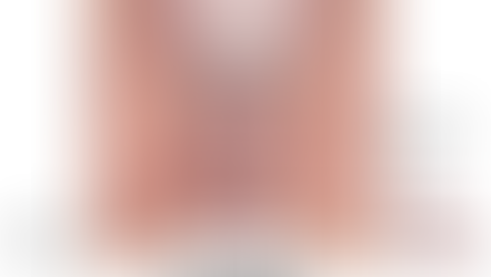 Anal Fissür (Bağırsak Yırtığı)