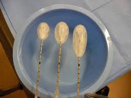 Cryoablation working principle; Ice ball formation and cell death after cancer is reached with a nee