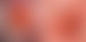 Rahim Ağzı Yarası ve Tedavisi- Servikal Erozyon