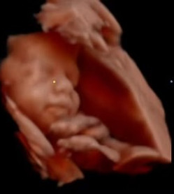 an image of 8k ultrasound result