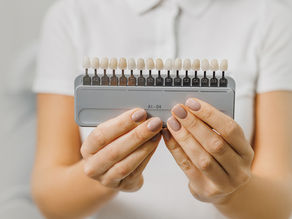 A Guide to Cosmetic Dental Veneers and How We Use Them