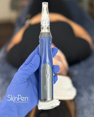 SkinPen.png