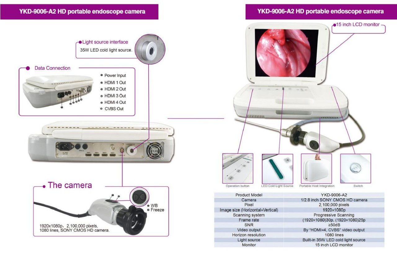 Portable HD Endoscopy System (Rigid only)