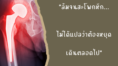 ผู้สูงอายุล้ม "สะโพกหัก" ภัยเงียบที่เปลี่ยนชีวิต! ทำไม "กายภาพบำบัดที่บ้าน" ถึงเป็นกุญแจสำคัญสู่การกลับมาเดินได้อีกครั้ง?