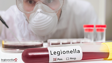 analisi Legionella Roma.png