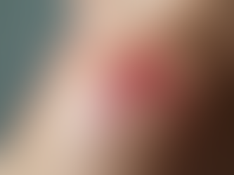 Finding Your Ideal Scar Revision Specialist