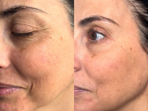 Enquanto marcas cobram até R$700 por 30g, Dermabem aposta em retinol puro de padrão clínico e ganha destaque entre dermatologistas