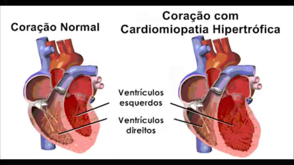 Cardiomiopatia Hipertrófica Felina, que bicho é isso?!