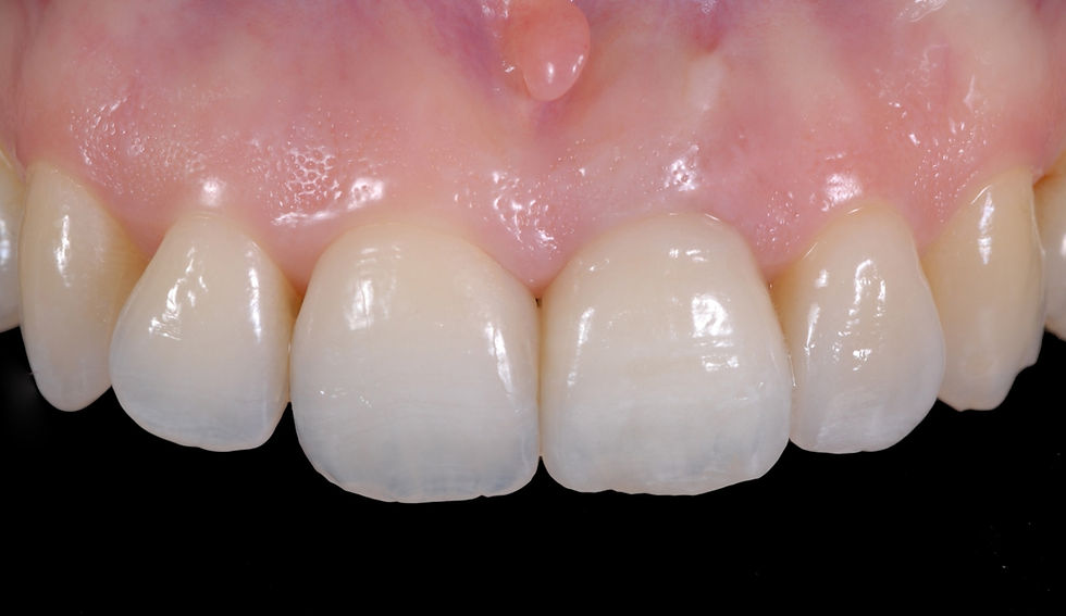 Thumbnail: "Discovering Tooth Morphology with Shigeo Kataoka"