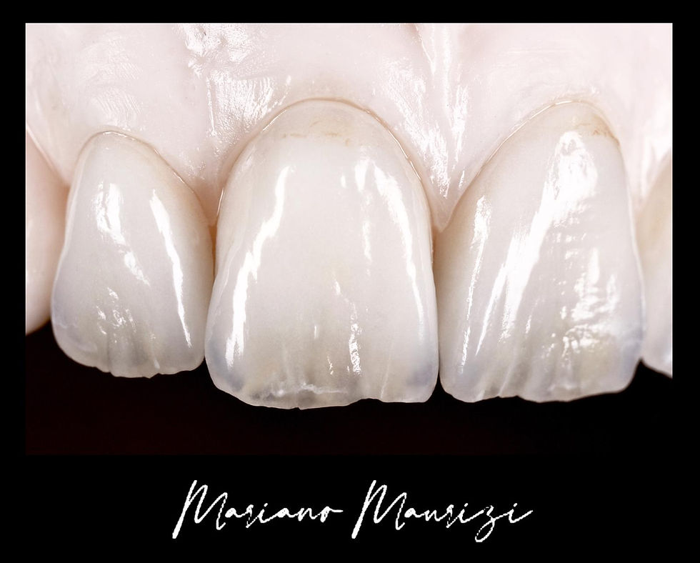 Thumbnail: Master Modern Chairside Estchtetics.
