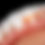 Thumbnail: Immersion in Professional Dental Photography with specialist Dr. Renato Ferreira