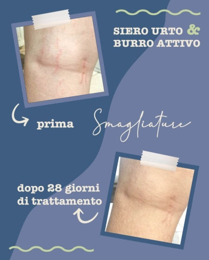 Miniatura: Siero Urto Smagliature - La Saponaria 