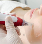 DERMAPEN_edited.jpg