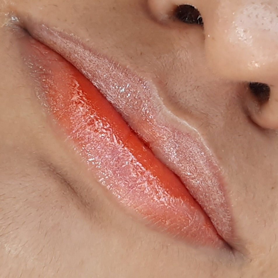 Miniatura: Micro Labial (Neutralização ou Revitalização)