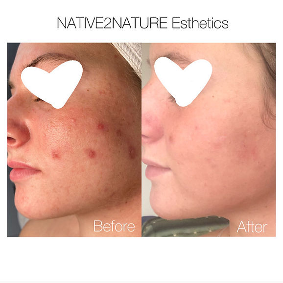 celluma beforeandafter.jpeg