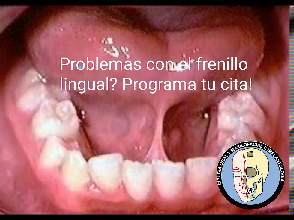 Problemas con el Frenillo lingual
