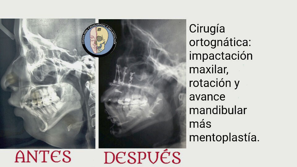 ortognática radiográficamente