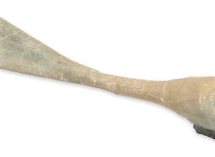 tendon de aquiles.png