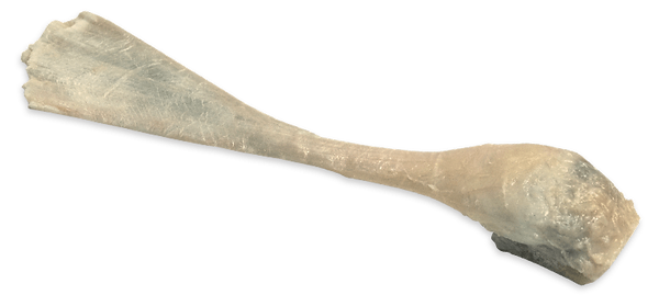 tendon de aquiles.png
