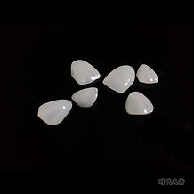 E-max Ultra Veneers.jpg