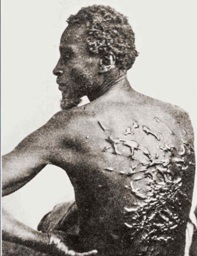 Scarred Enslaved Black Man