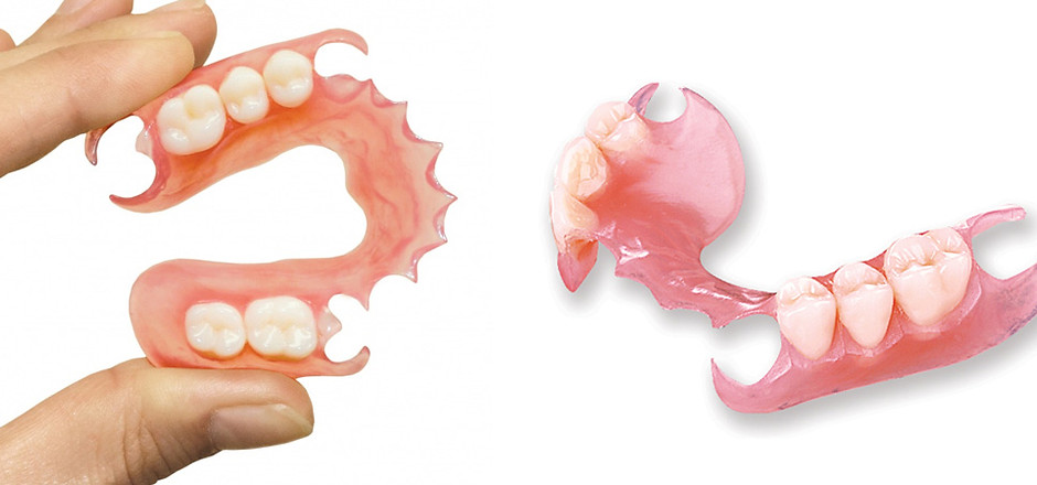flexible-dentures.jpg
