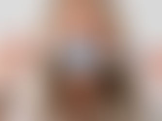 Does Laser Teeth Whitening Hurt? What to Expect