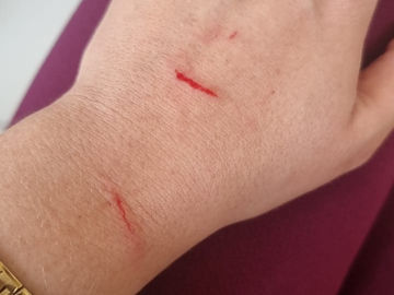 Servidora envolvida em episódio de agressão se manifesta através de nota