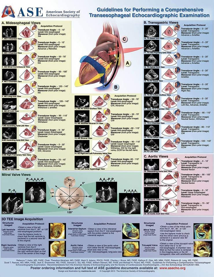 Posters from ASEcho.org showing various echo techniques and pathologiesPosters from ASEcho.org showing various echo techniques and pathologies