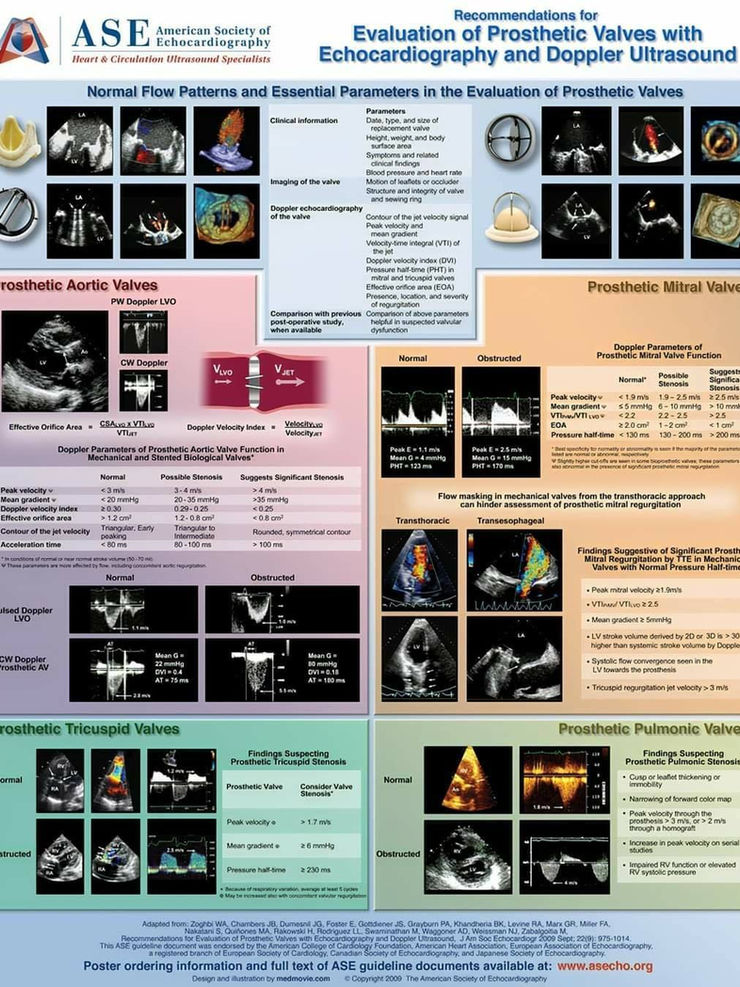 Posters from ASEcho.org showing various echo techniques and pathologies