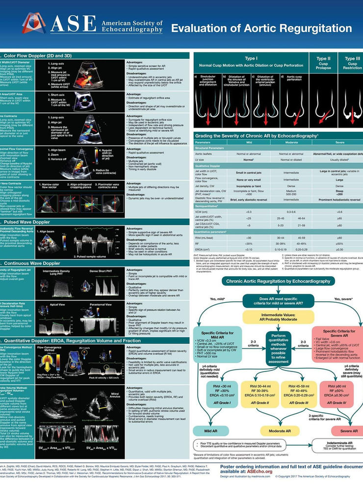 Posters from ASEcho.org showing various echo techniques and pathologies