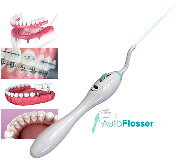autoflosser compilation with logo.png