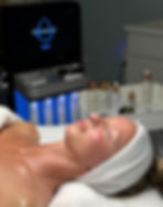 A woman with glowing, healthy-looking skin after a Hydrafacial skin treatment.