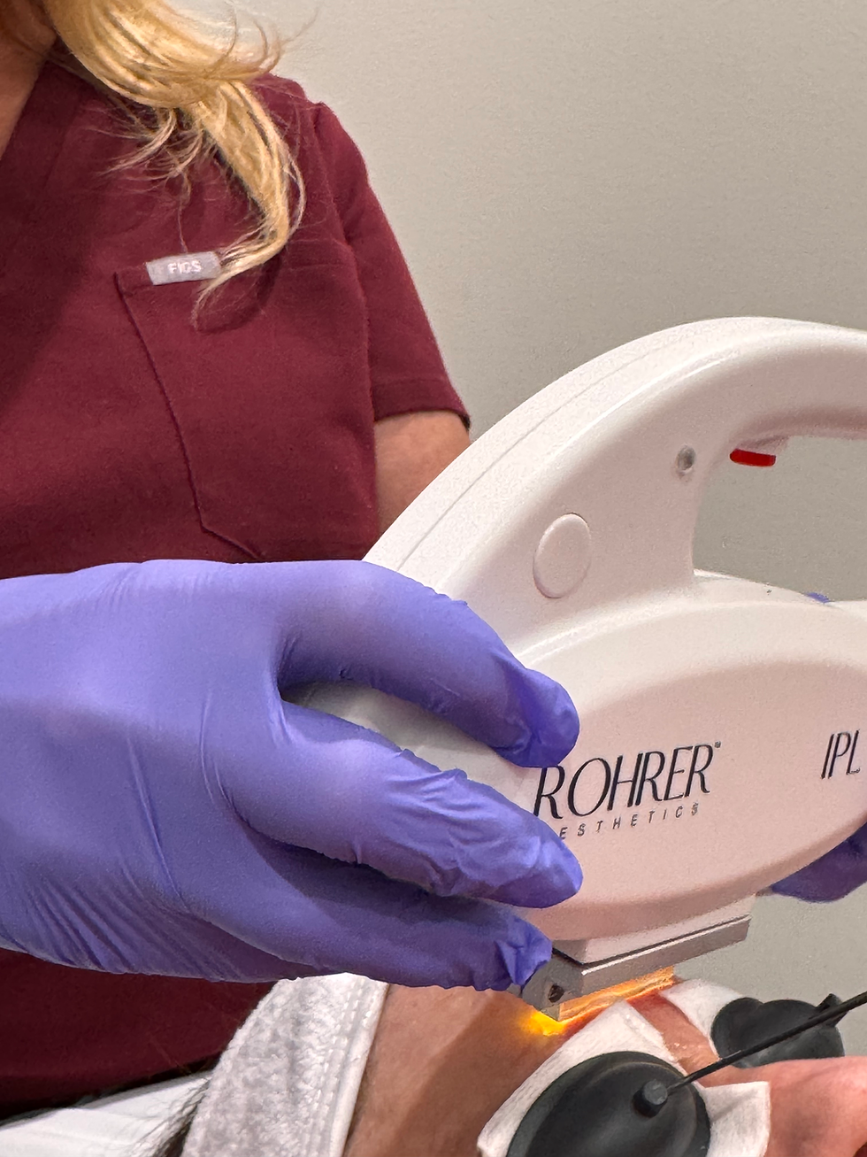 Rohrer IPL Treatment