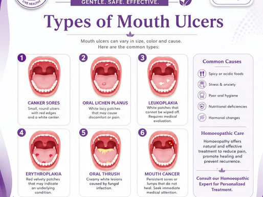 🌿Mouth Ulcers (Aphthous Ulcers) – Relief with Homoeopathy🌿