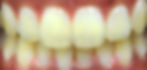 Case 8 BEFORE