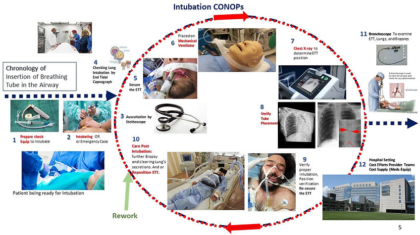 Intubation-Process.jpg