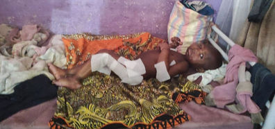 Camminiamo Insieme per la Salute dei Bambini: Una Storia di Speranza e Impegno