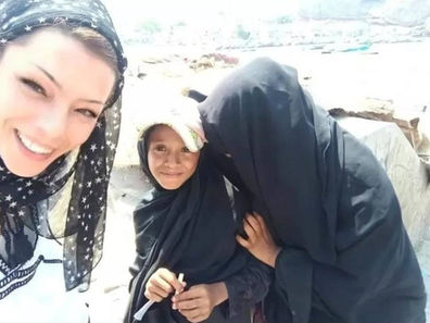 Bambini Malnutriti Yemen