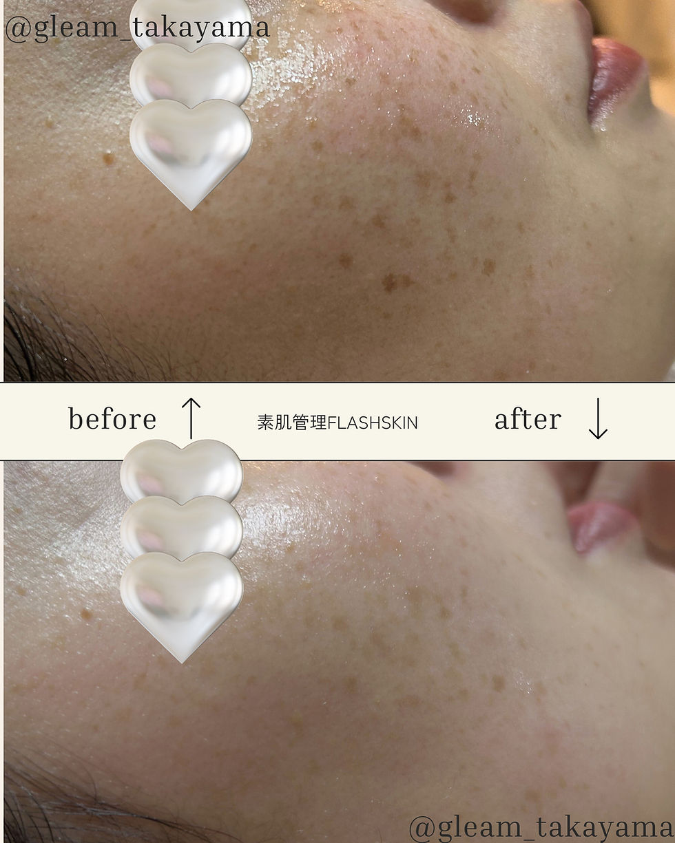 Flash SKIN ビフォーアフター✨