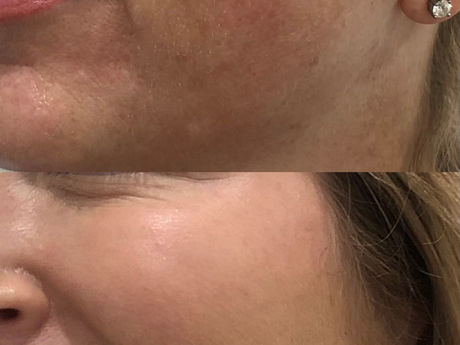 Love your skin, why we say "I DO" to MOXI