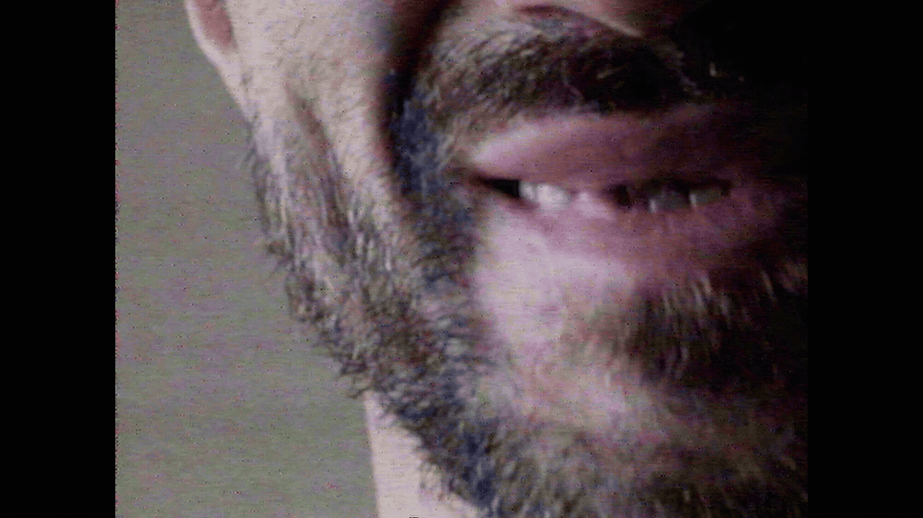 dente faltando