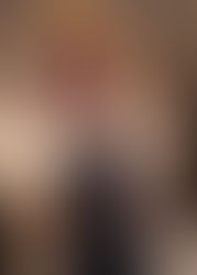 Մարտունիում պայթյունից տուժած հոգեւորականի առողջական վիճակը գնահատվում է միջին ծանրության