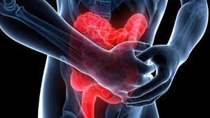 12 շաբաթ D վիտամին ընդունելն օգնում է վերագործարկել աղիների հիվանդություններ ունեցողների իմունային համակարգը